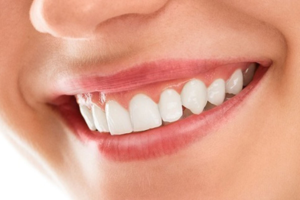 Facts About Smile Reconstruction