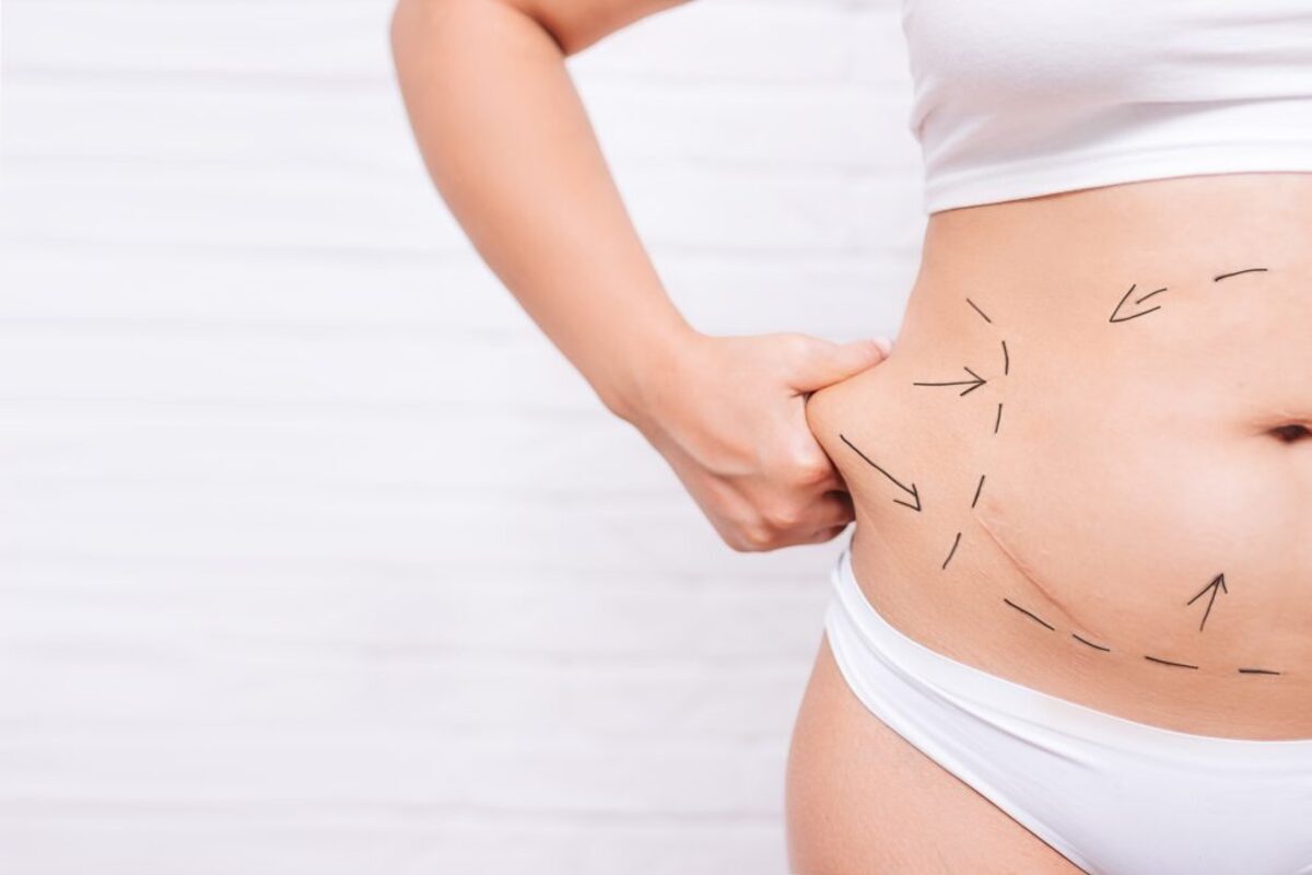 Best Liposuction – Discover The Simple Facts About Them